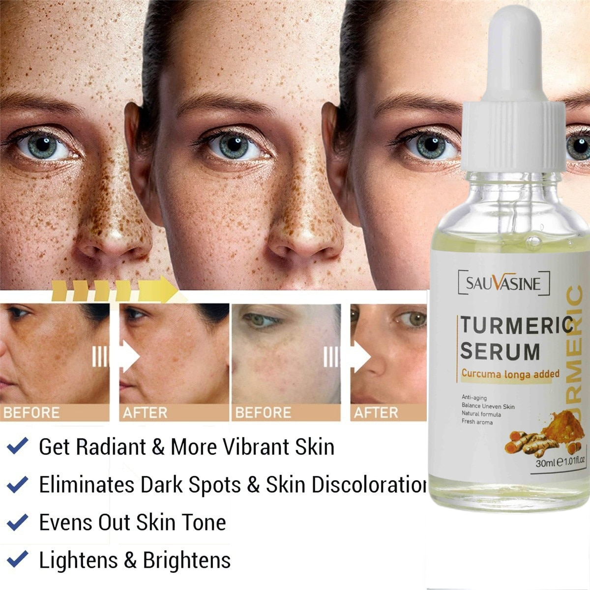 Freckle Whitening Serum