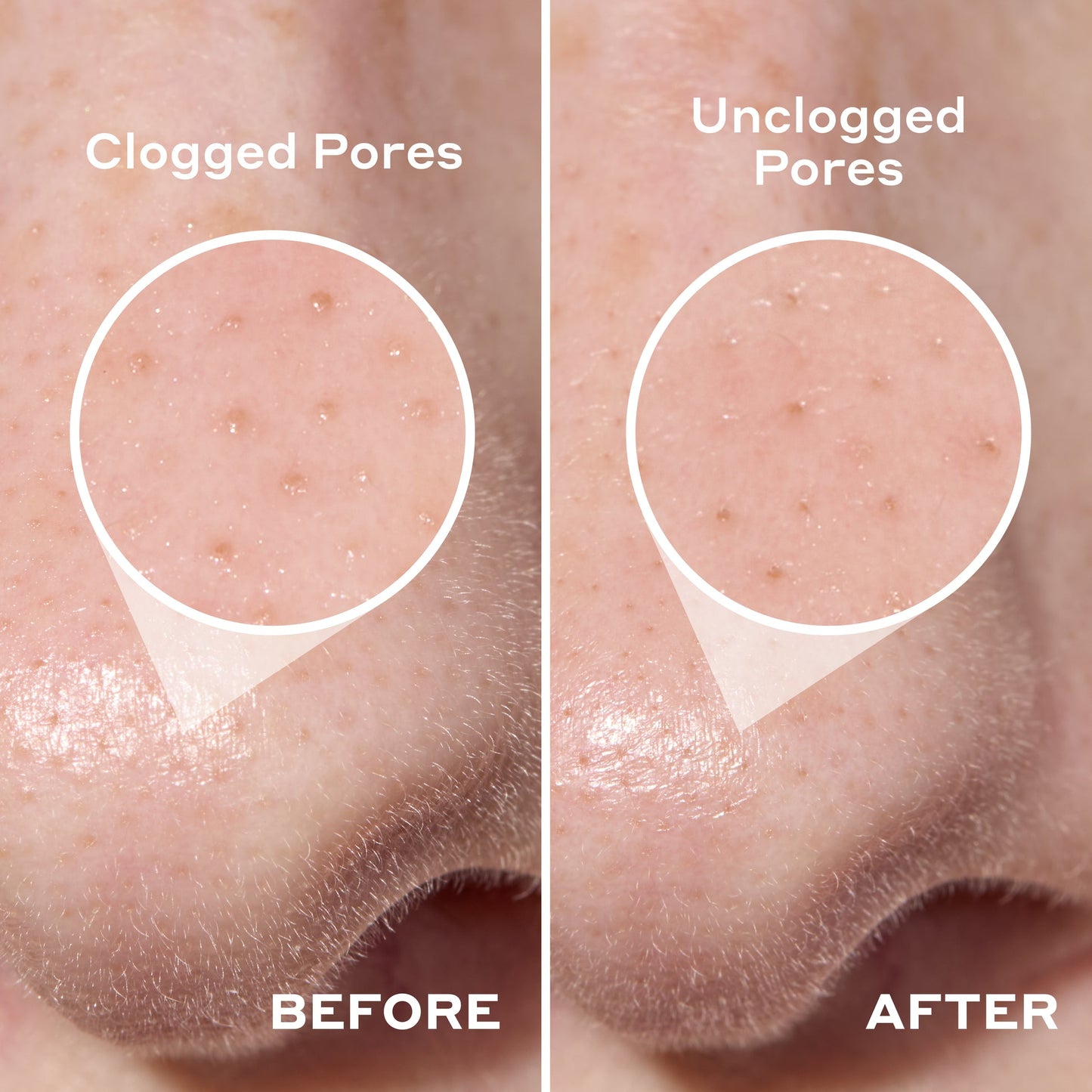 Deep Cleansing Pore Strip