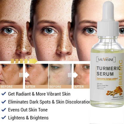 Freckle Whitening Serum