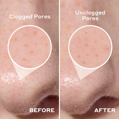 Deep Cleansing Pore Strip