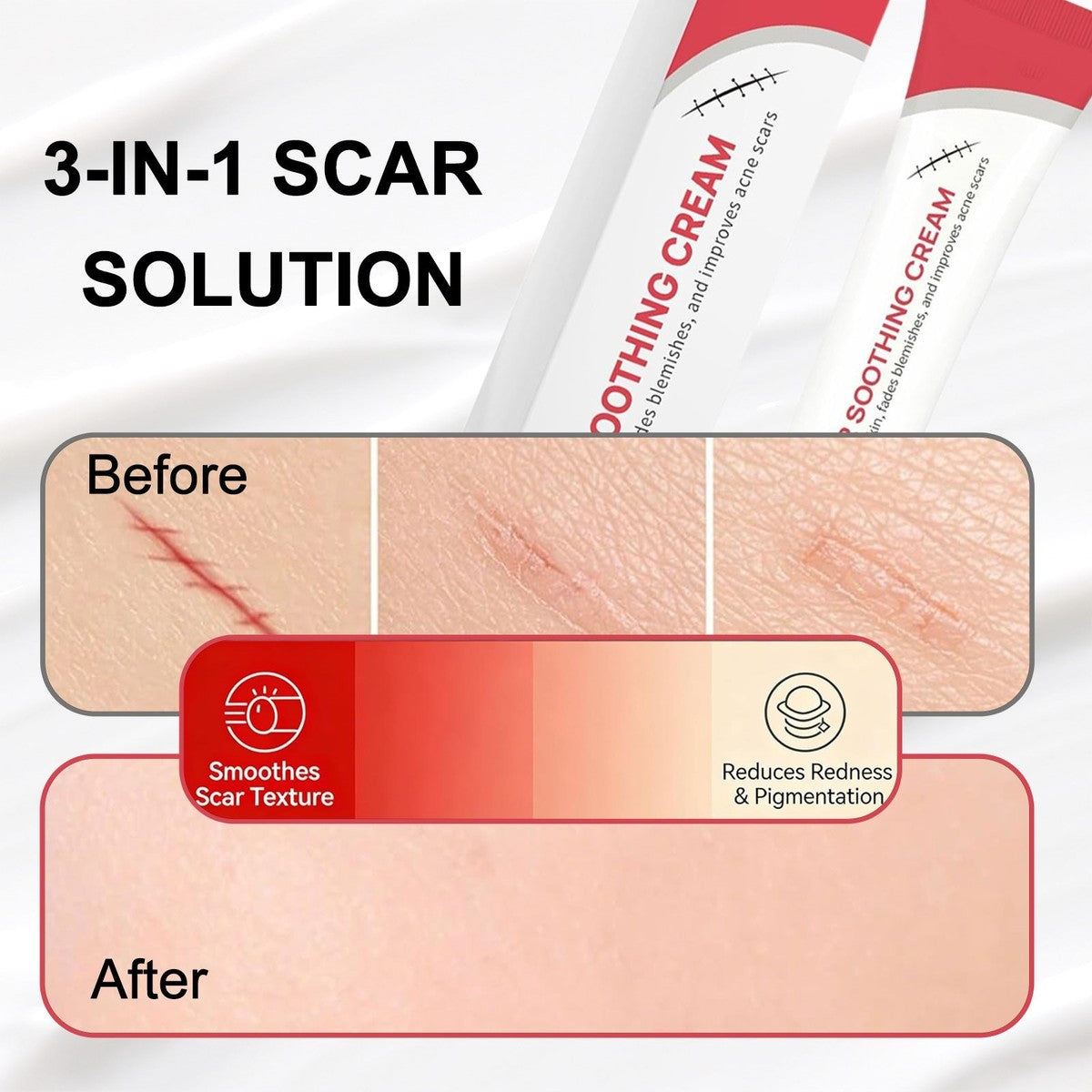 All Natural Wart Removal Cream