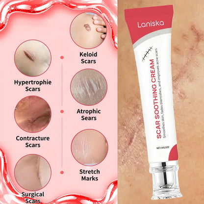 All Natural Wart Removal Cream