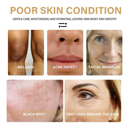 Freckle Whitening Serum