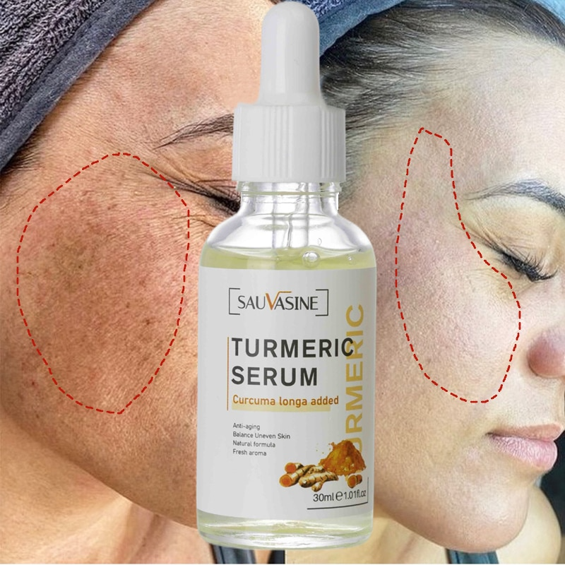 Freckle Whitening Serum